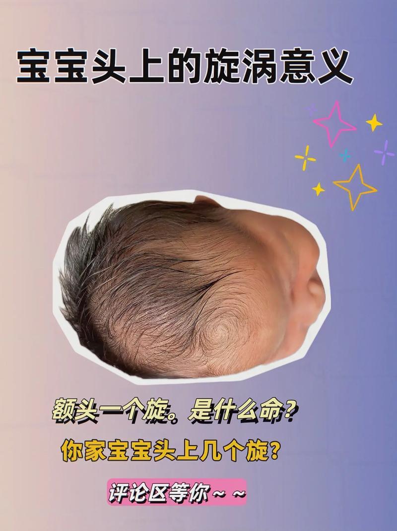 額頭有旋