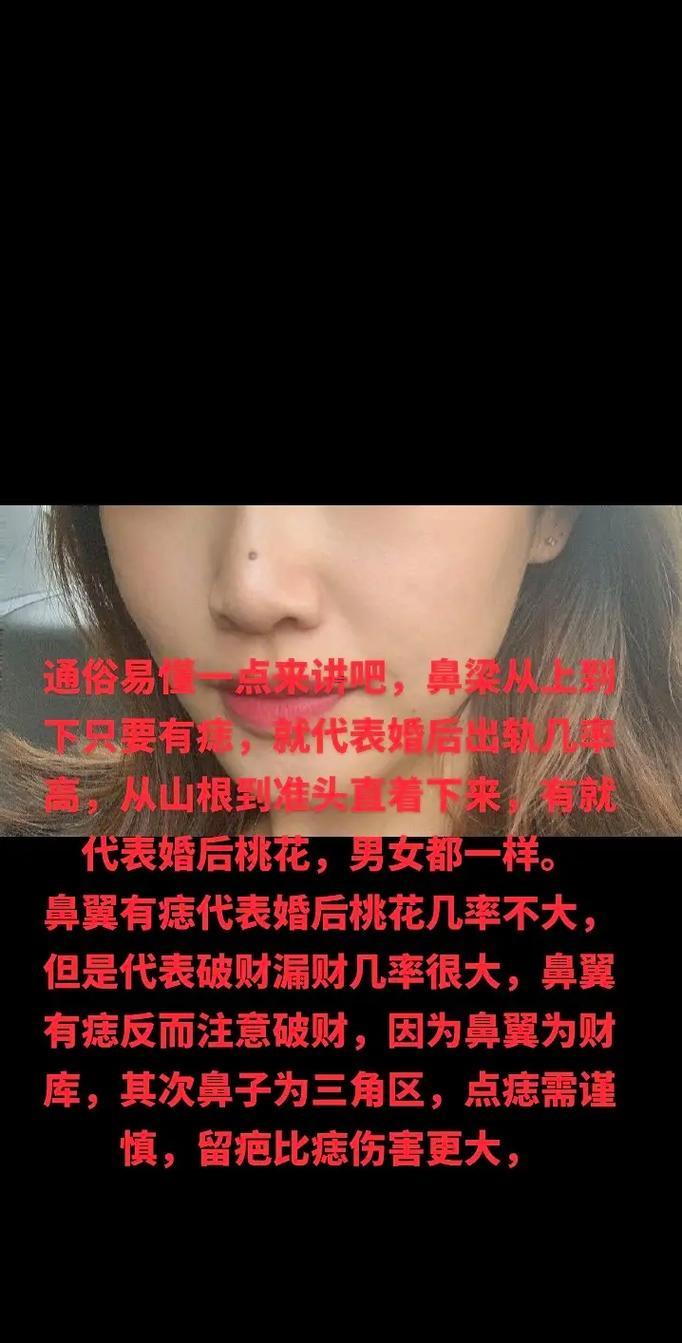鼻子上長(zhǎng)痣好不好