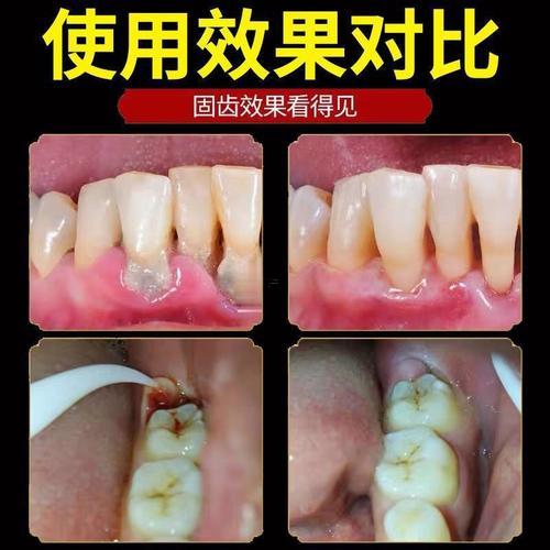 牙齒縫隙大