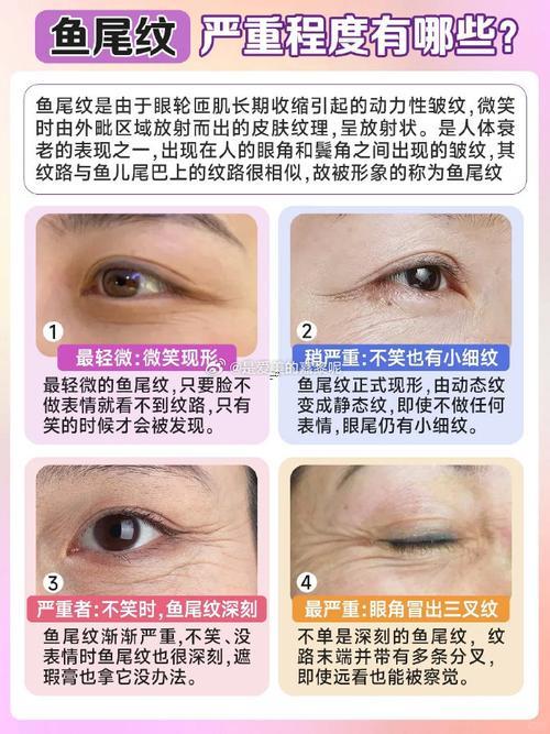 魚尾紋面相