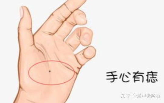 眼下有痣