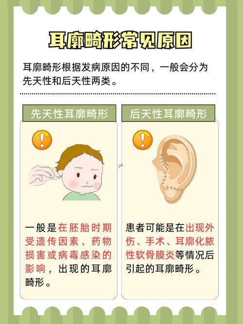 耳廓外翻