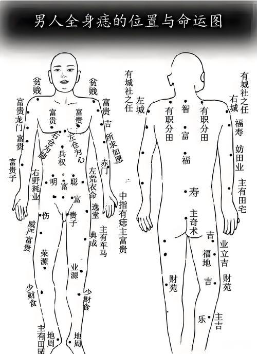 屁股有痣
