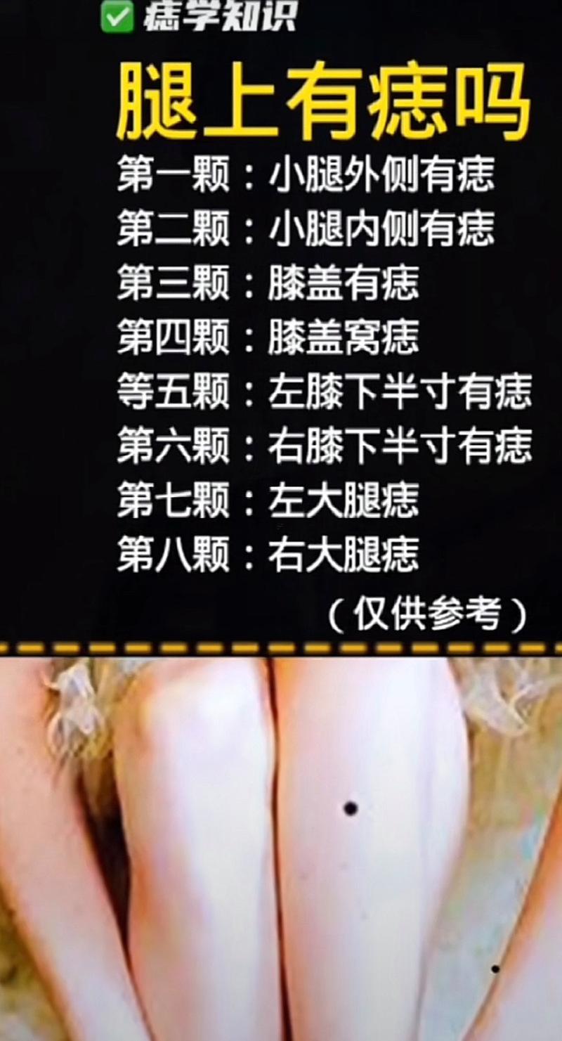 膝蓋有痣