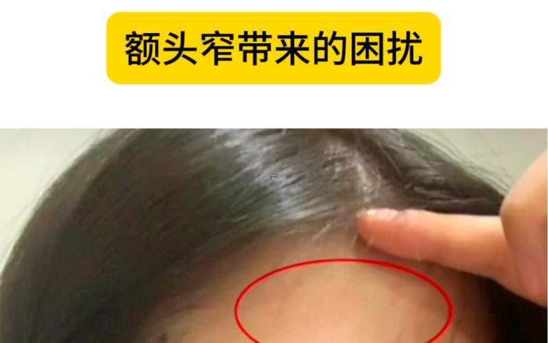 頭尖額窄面相