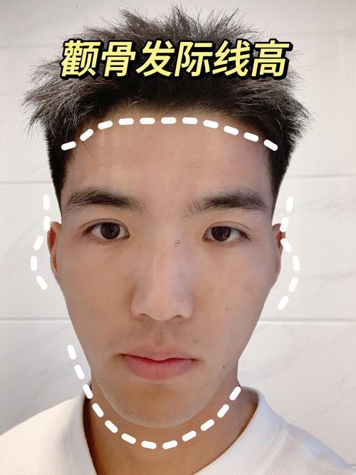 顴骨高克夫
