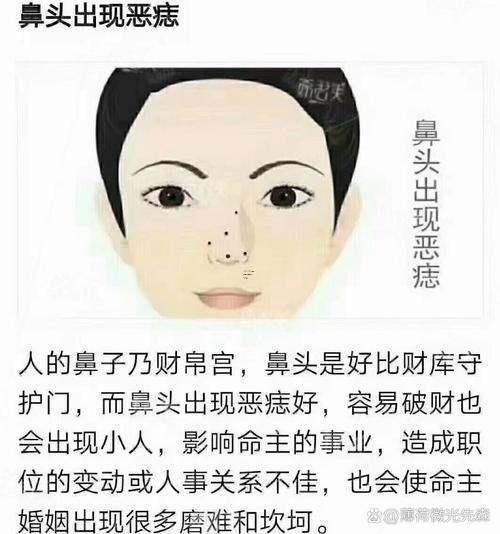 鼻子有痣的男人