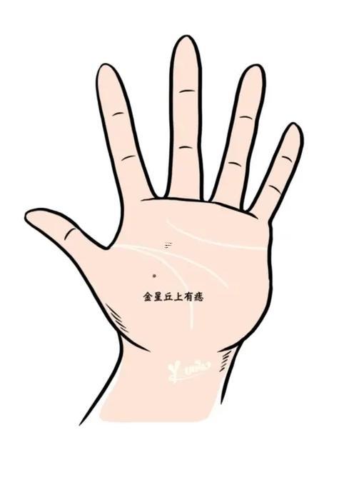 手掌有痣圖解大全