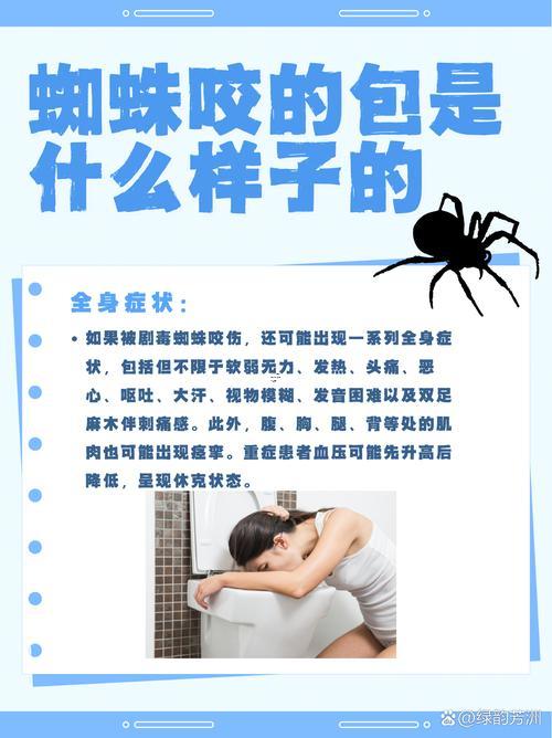 夢(mèng)見(jiàn)被蜘蛛咬了