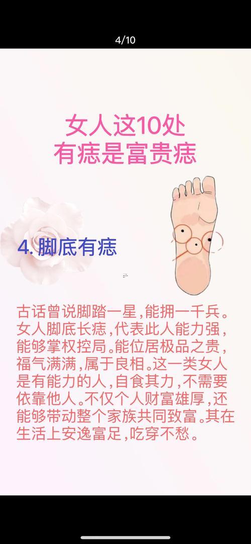 命中有貴子的痣