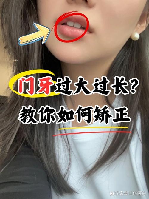 下門牙中間有縫