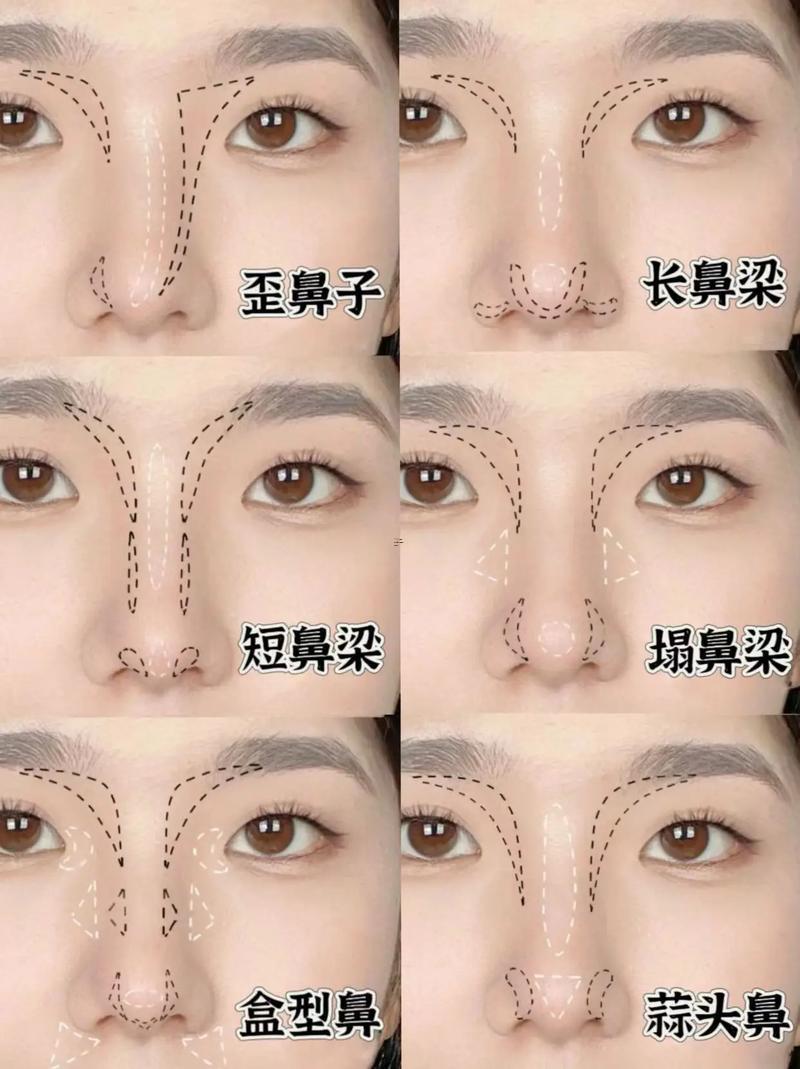 鼻子的類型有幾種