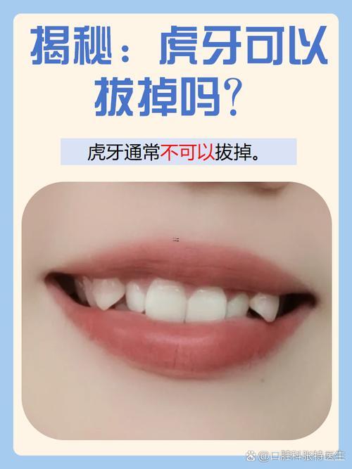 虎牙能拔嗎