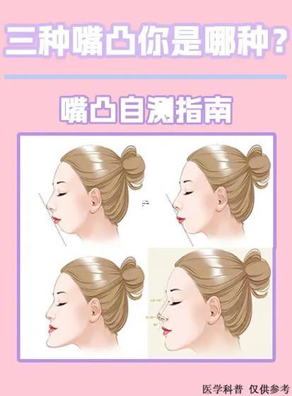 嘴巴明顯
