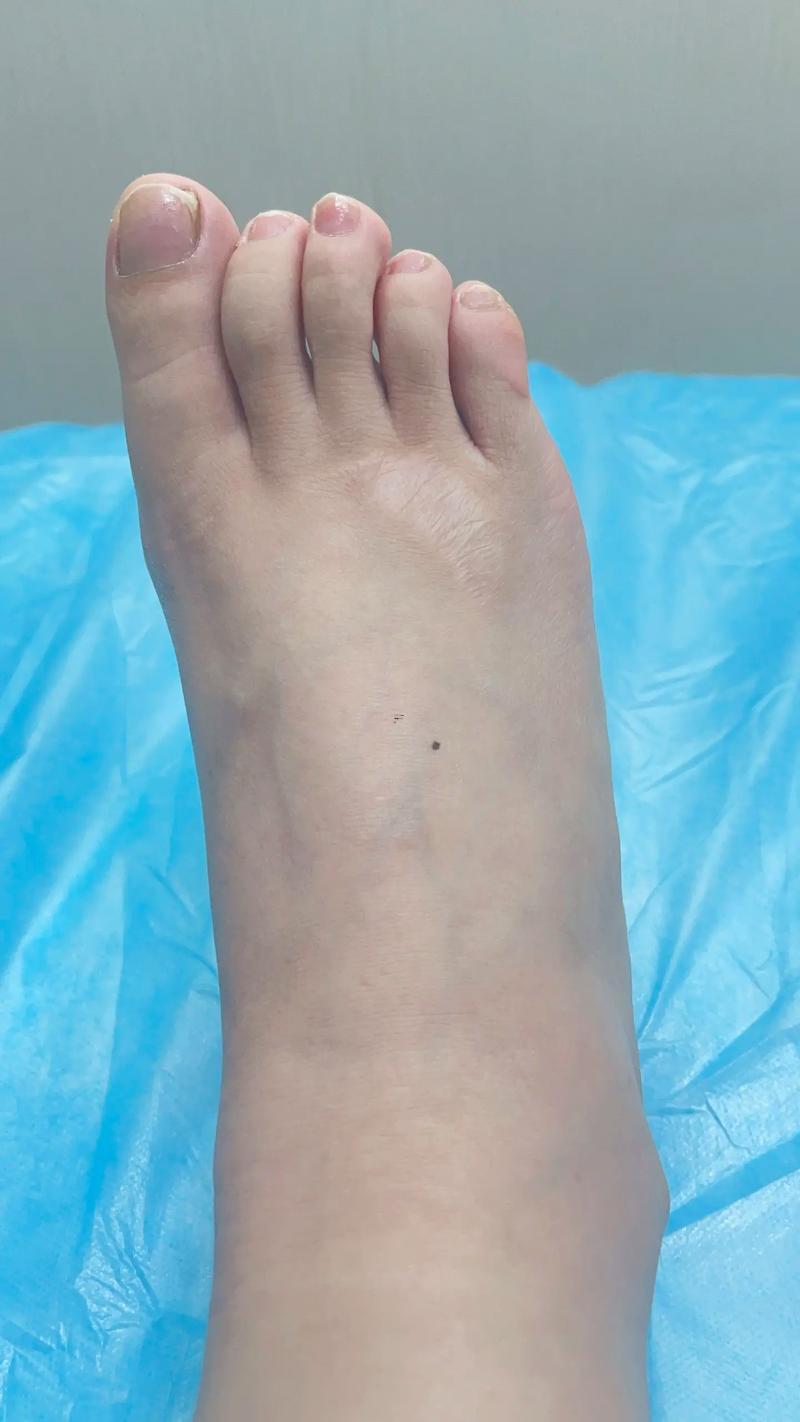 胸前長痣