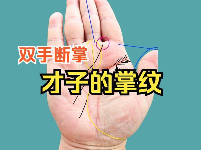 兩只手都是斷掌的男孩