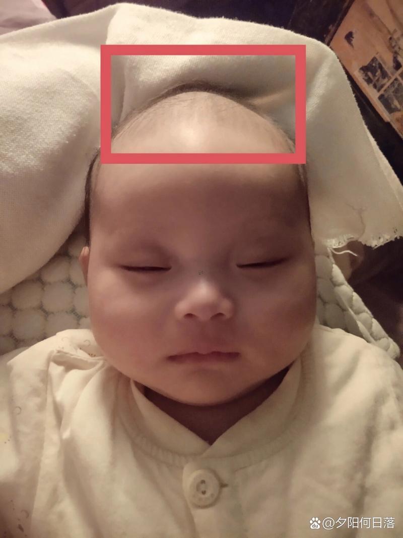 頭頂正中骨頭凸起