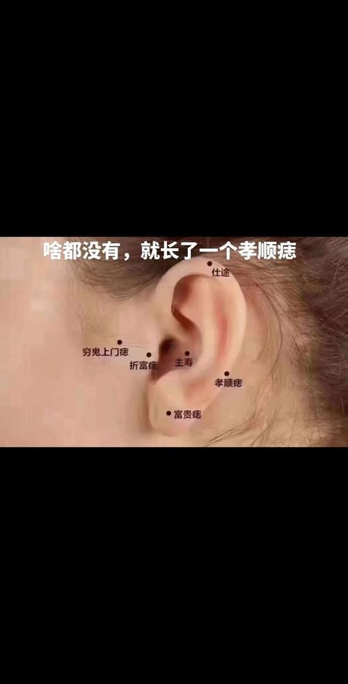 右耳垂有痣的女人
