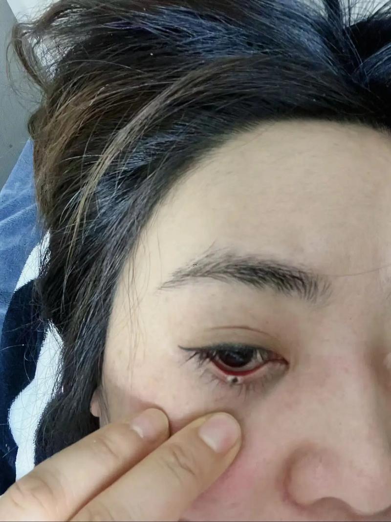 淚痣在哪個位置
