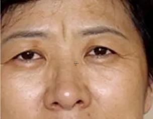 懸針紋女人的命運(yùn)