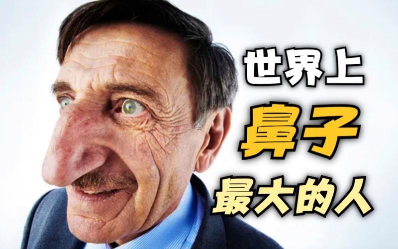 眼睛最大得人