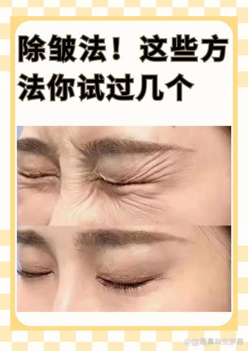 額頭有皺紋怎么辦