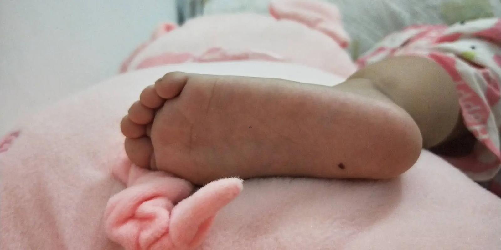 腳底板有痣
