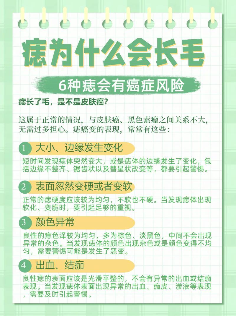 痣上長(zhǎng)毛好不好
