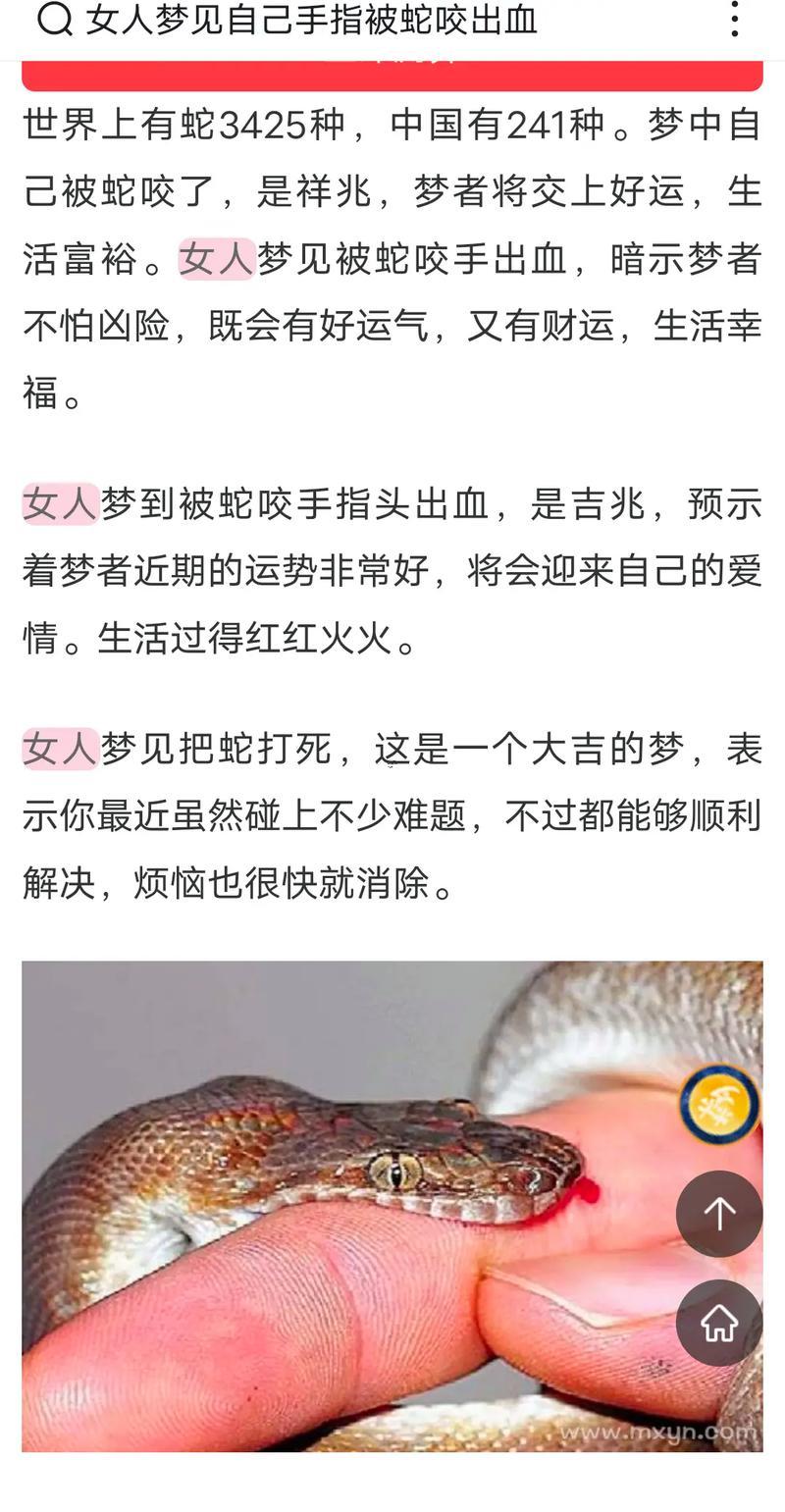 夢見蛇咬手