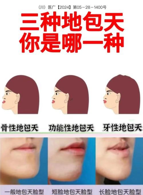 地包天面相女