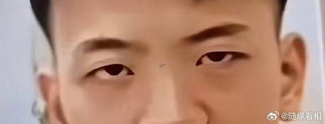 什么是三角眼