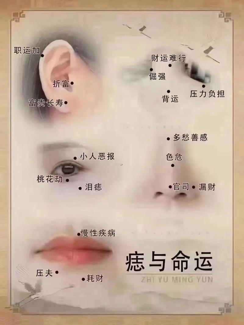 何事是痣