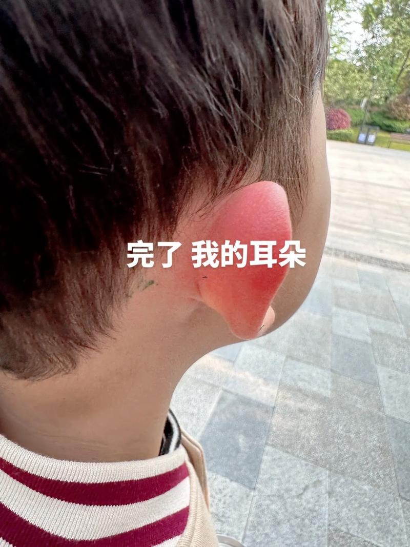 什么東西東西是招風耳