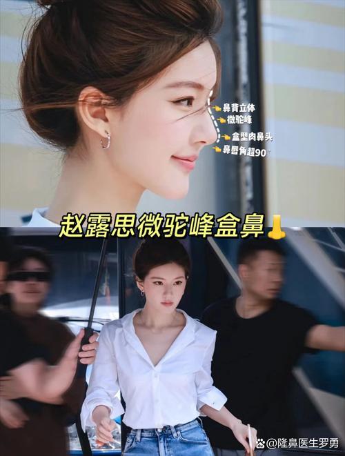 高鼻梁有何事益處