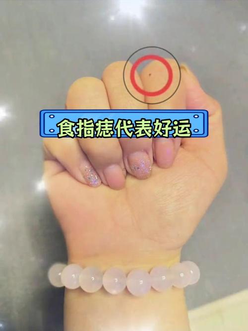食指長痣