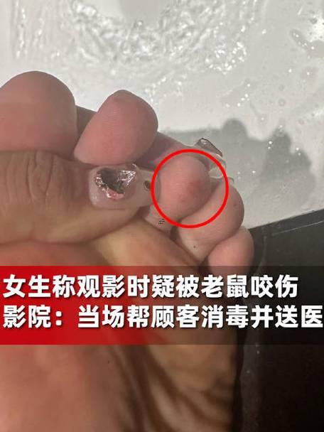 夢見老鼠咬自己