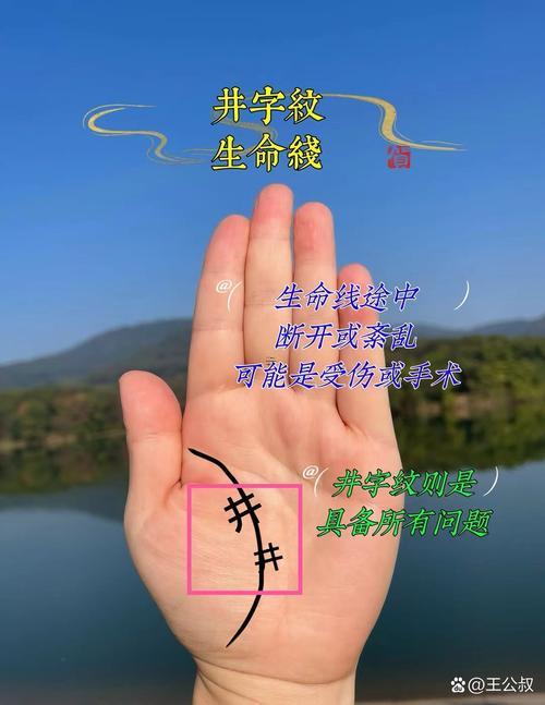 手掌有痣的女人