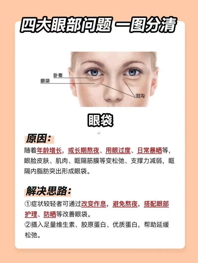 眼袋跟臥蠶的區(qū)別