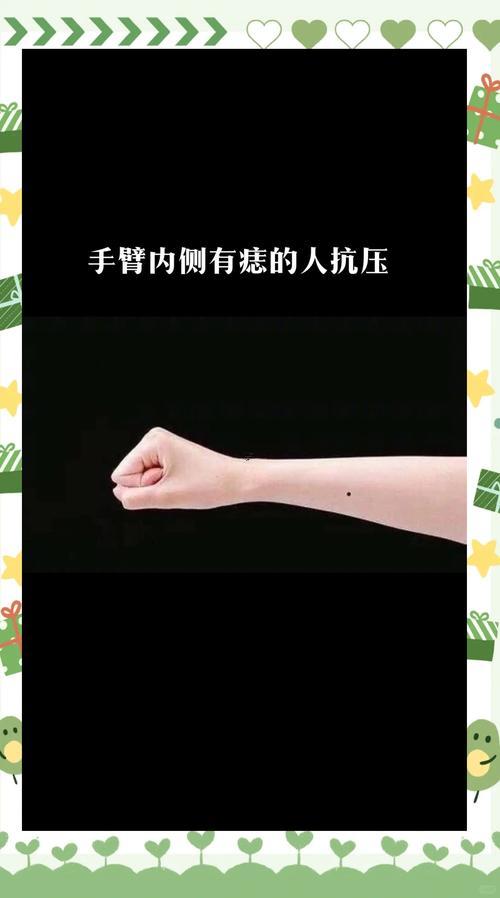 右手有痣