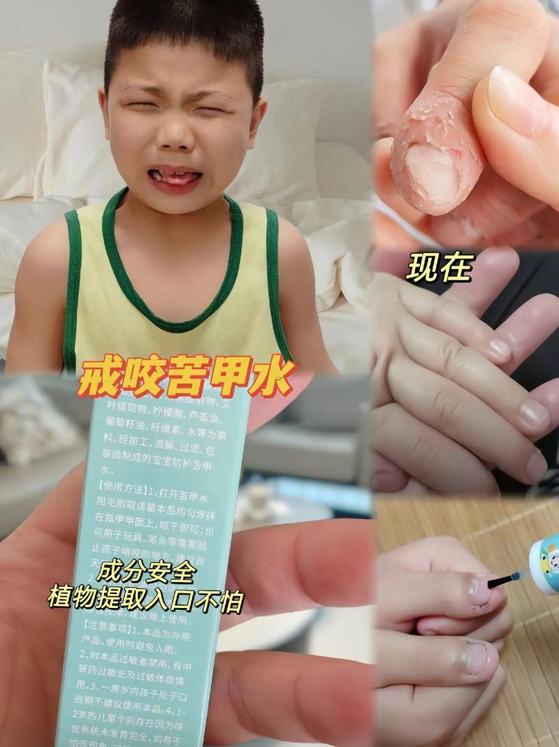 夢見吃蟲子