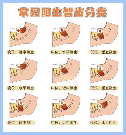 長智齒證明何事