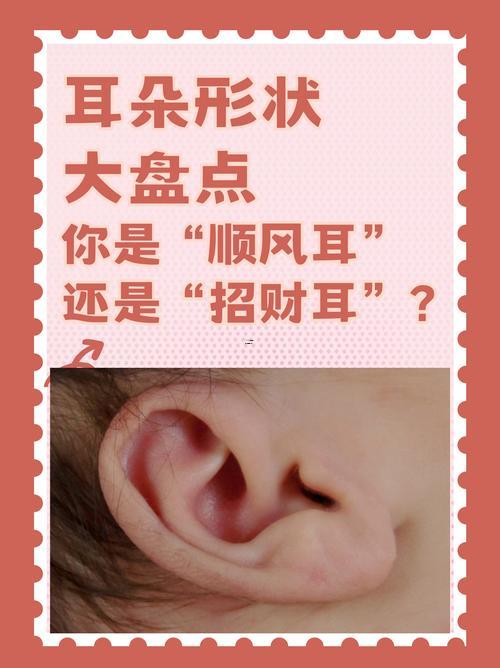 招風(fēng)耳好嗎