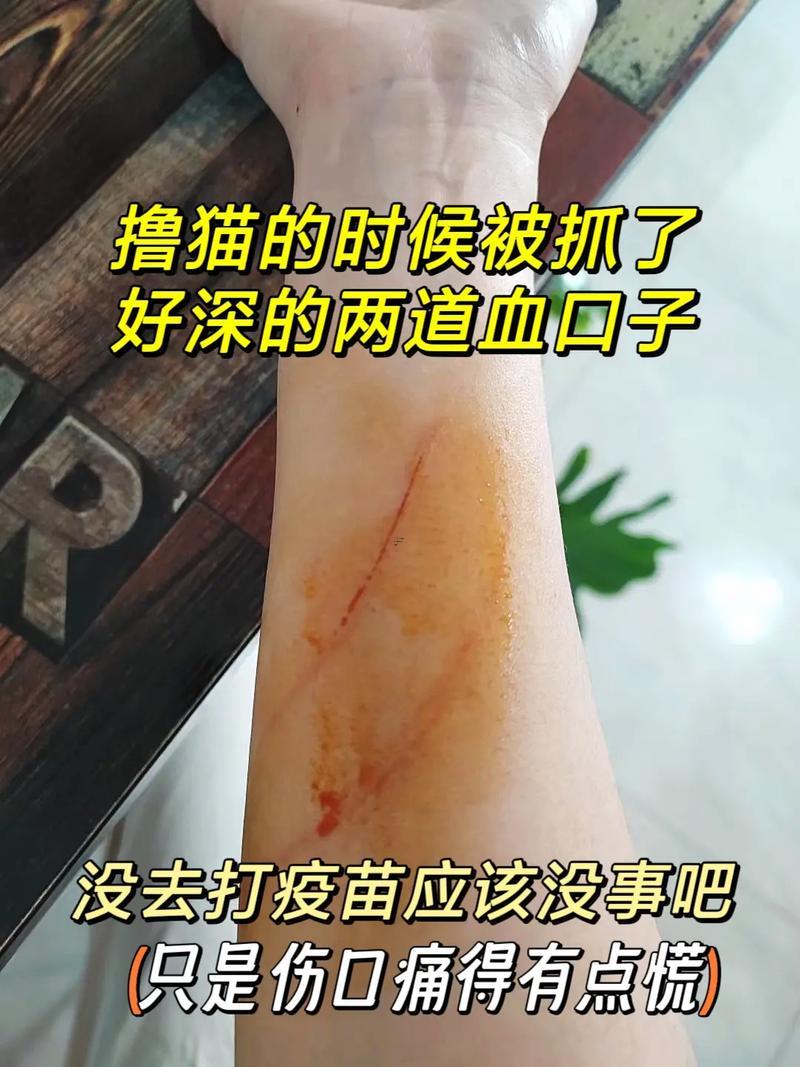 夢見被貓抓傷