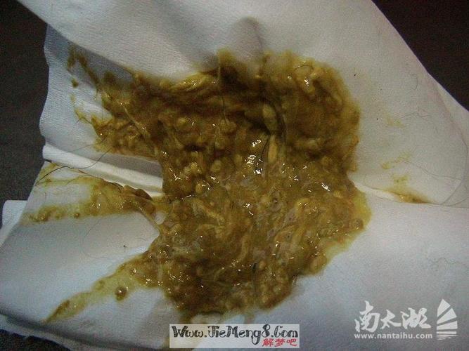 做夢拉屎好不好