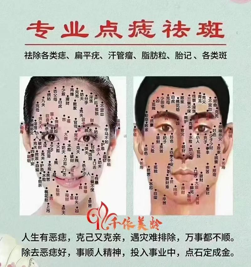 面部祛痣圖風(fēng)水圖