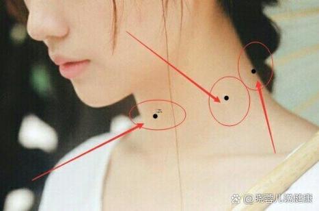 脖子上得痣