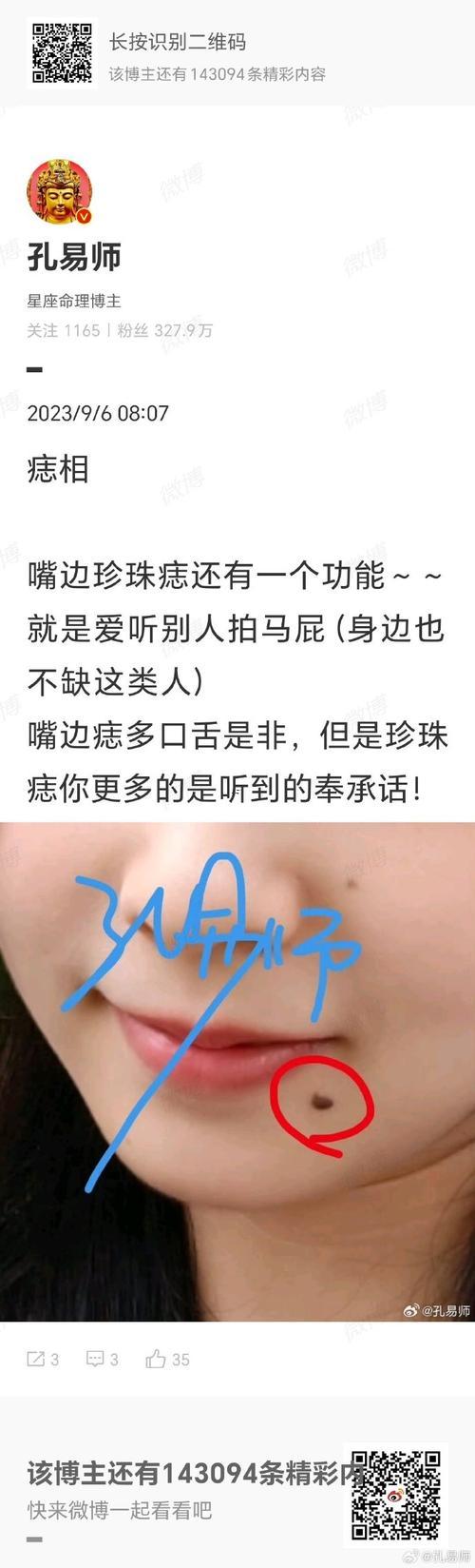 嘴邊長(zhǎng)痣