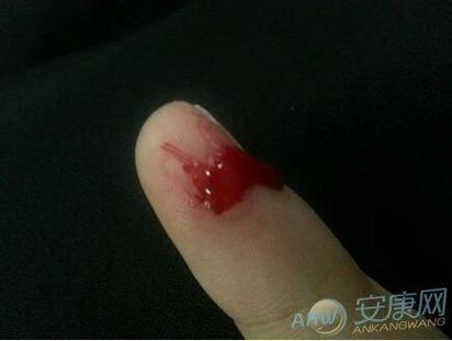 夢里夢到自己出血啦
