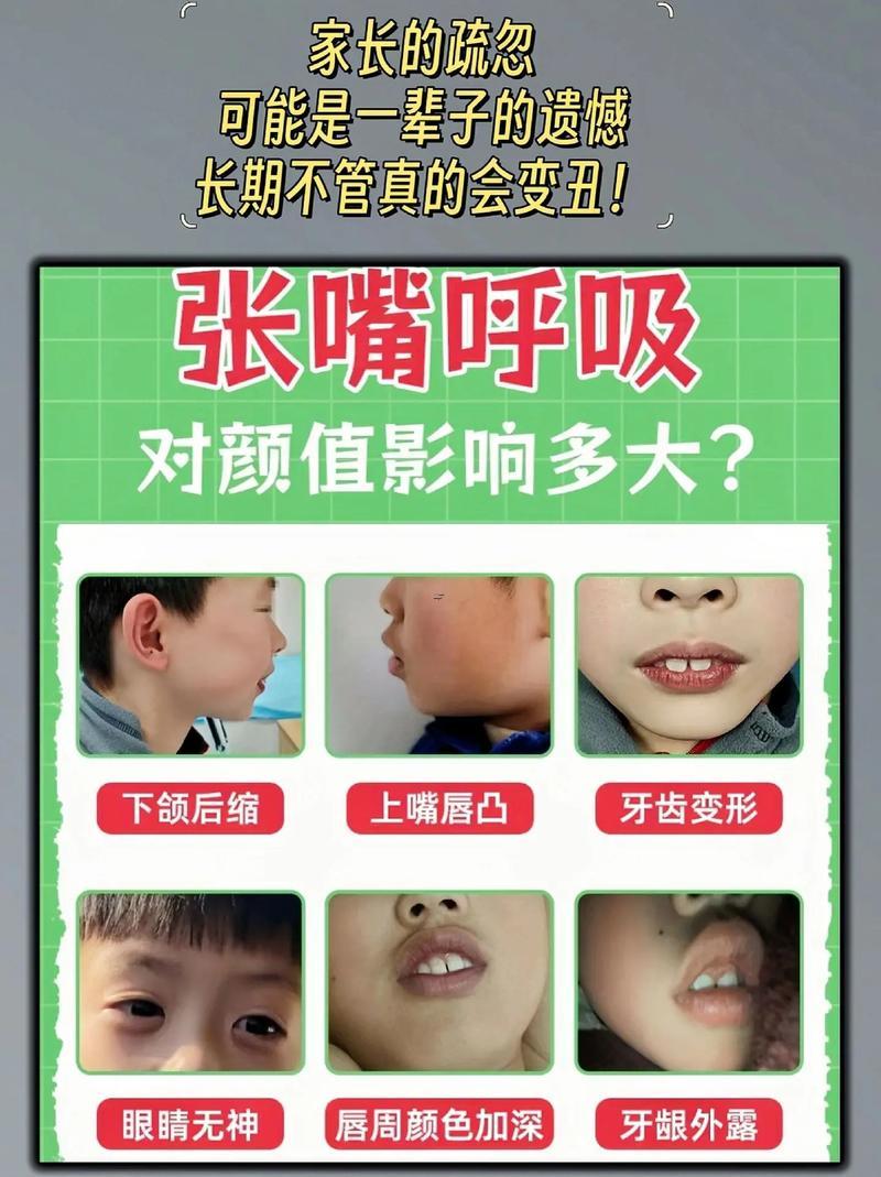 上嘴唇薄