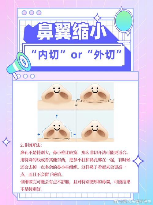 鼻頭大鼻翼寬